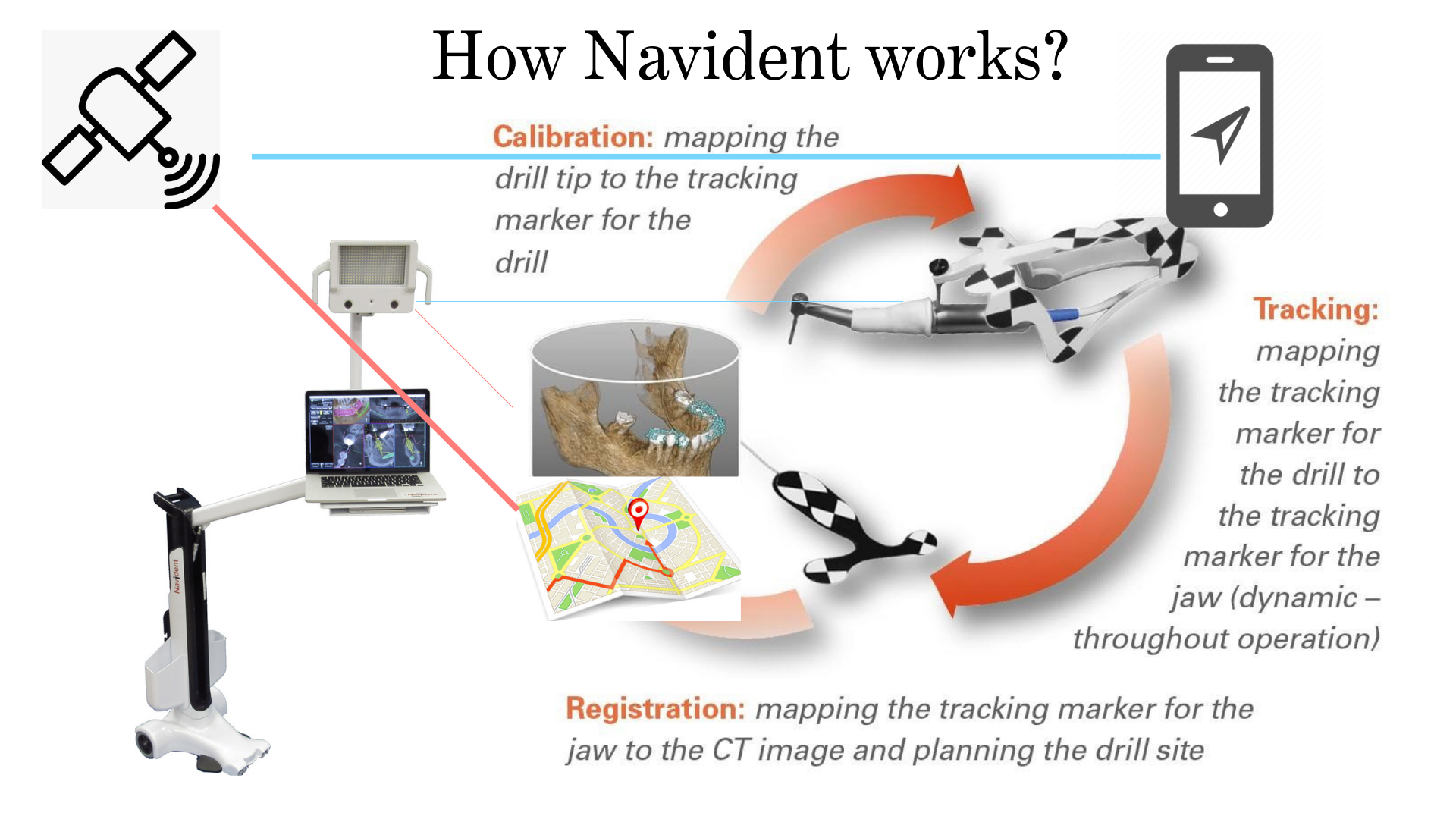 Navident AR Glasses clinical workflow